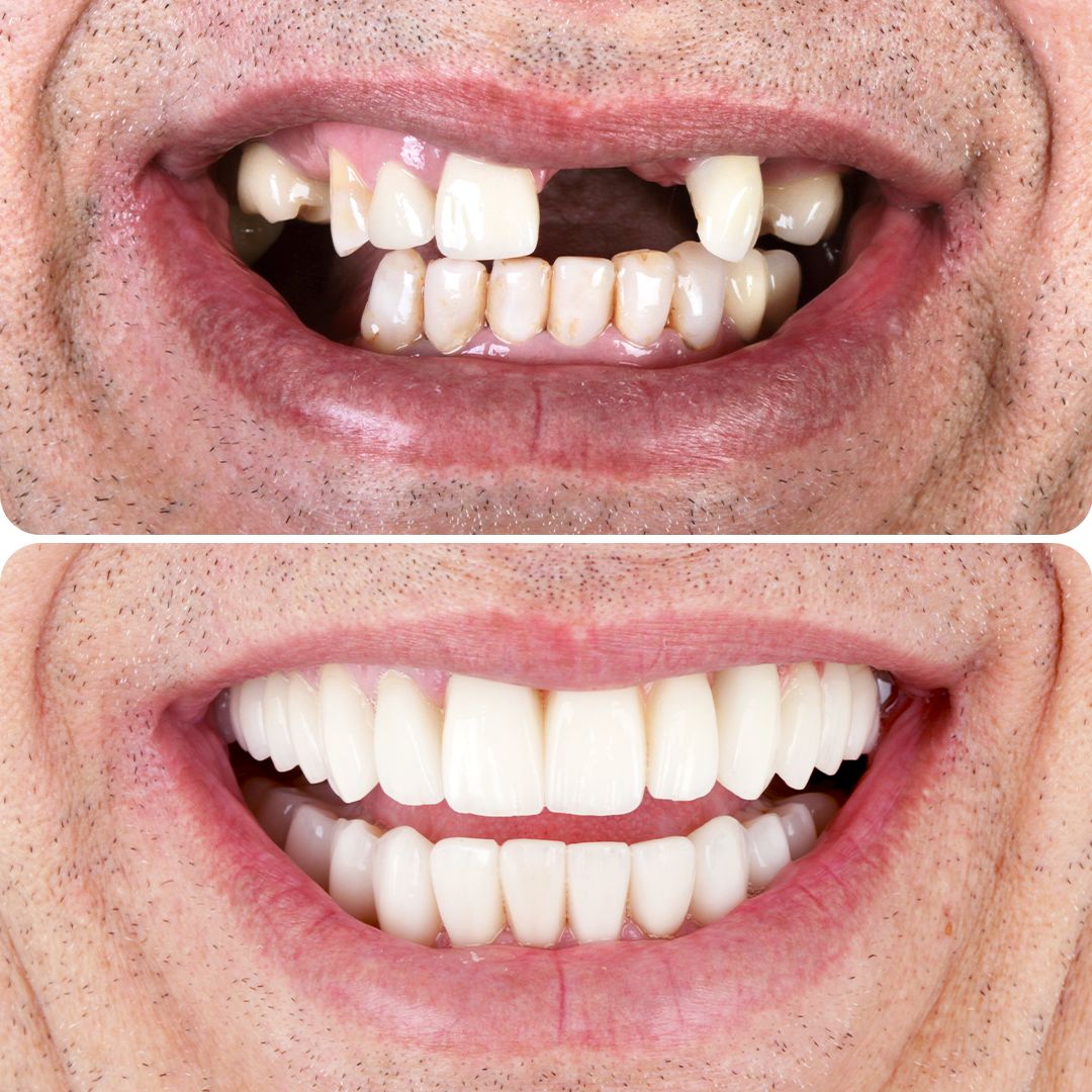 807bccedf815a4f1774f449a29941d9b