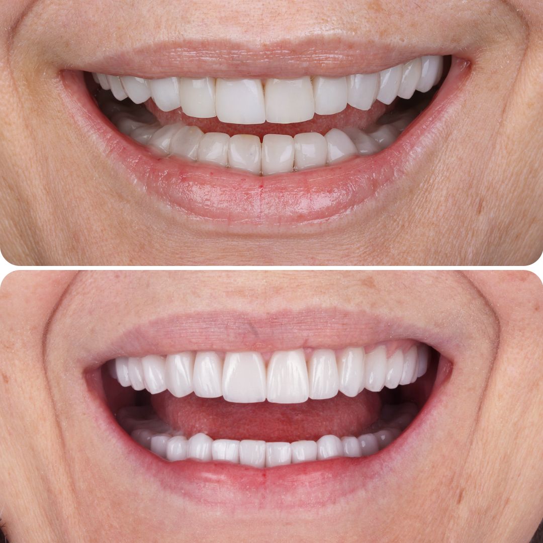 9e61fde7d1beec06af061fbc2d433283