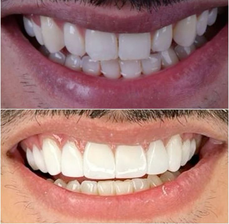 bf900da28853da98e1a455059686a845